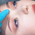 The Evolution of Facial Fillers: A Look at the Past and Present