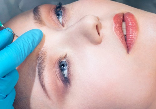 The Evolution of Facial Fillers: A Look at the Past and Present